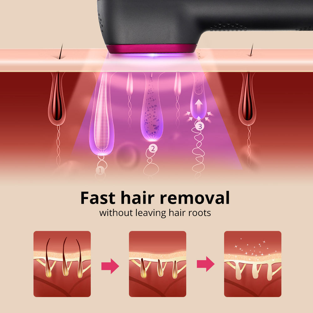 1PCS Laser Hair Removal For Women And Man 100,000 Flashes