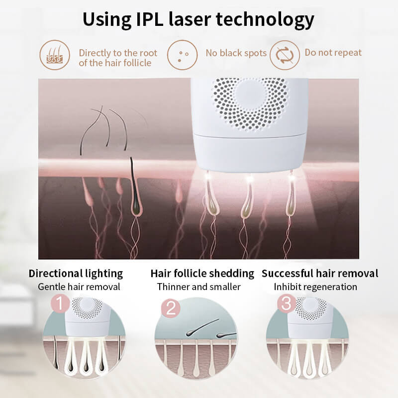 990,000 IPL laser hair removal device